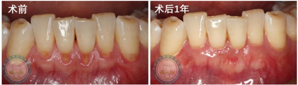 图片 20.jpg 图片 20.jpg